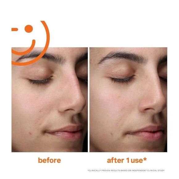 Kate Somerville ExfoliKate Daily Cleanser – Glycolic & Lactic Acid Exfoliating - Picture 8 of 12